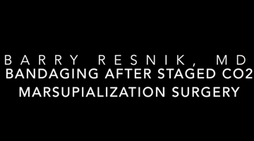 HS Bandaging after Staged CO2 Marsupialization Surgery