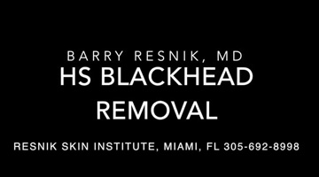 HS Blackhead Removal