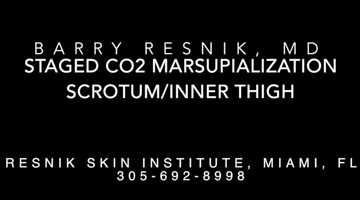 Staged CO2 Marsupialization Scrotum / Inner Thigh