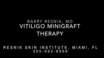 Vitiligo Minigraft Surgery